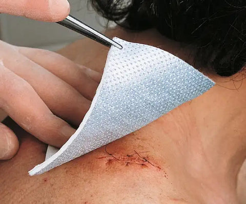 Metalline Kompresse Lohmann & Rauscher