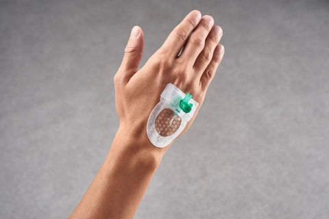 Curafix i.v. Control Kanülenfixierpflaster mit Sichtfenster - steril Lohmann & Rauscher