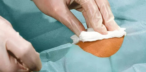 Foliodrape P Lochtuch Set I Hartmann