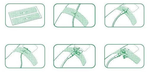 Curafix i.v. classic Kanülenfixierpflaster aus Gewebe - 20 Stück, geschlitzt Lohmann & Rauscher