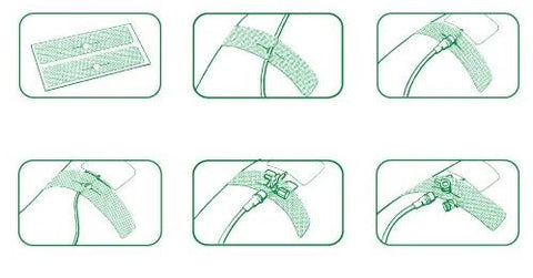 Curafix i.v. classic Kanülenfixierpflaster aus Gewebe - 20 Stück, geschlitzt Lohmann & Rauscher