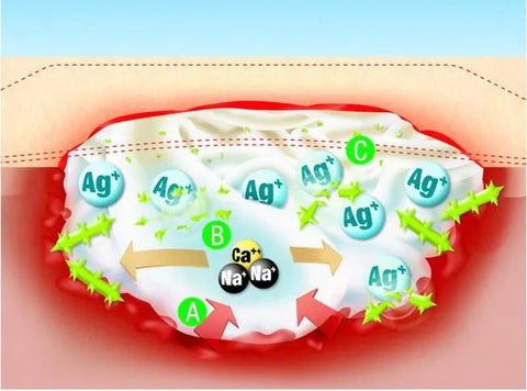 Suprasorb A+Ag antimikr. Ca-Alginattamp. steril, 2x30cm, 5 Stück Lohmann & Rauscher