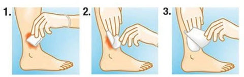 Suprasorb A+Ag antimikr. Ca-Alginattamp. steril, 2x30cm, 5 Stück Lohmann & Rauscher