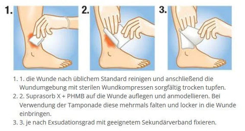 Suprasorb X+PHMB HydroBalance Tamonade Lohmann & Rauscher