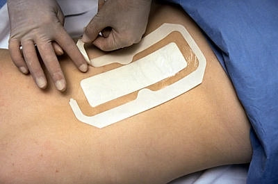 Tegaderm plus Pad steril 3M Medical