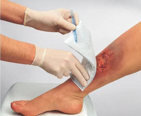 Vliwaktiv Aktivkohle-Saugkompresse Lohmann & Rauscher