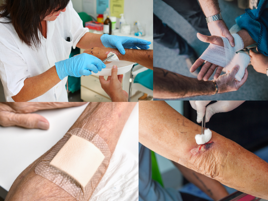 Ganzheitliche Wundversorgung: Von der Erstversorgung bis zur Heilung